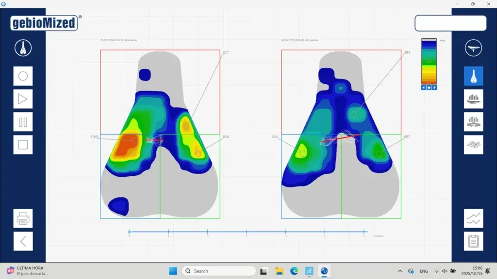 gebioMized Saddle Pressure Mapping 